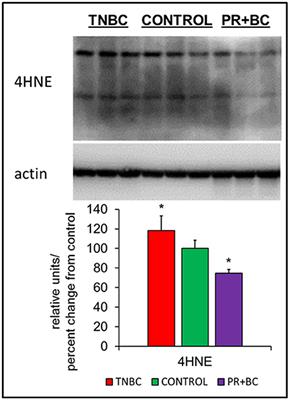 Growth of Triple Negative and Progesterone Positive Breast Cancer Causes Oxidative Stress and Down-Regulates Neuroprotective Transcription Factor NPAS4 and NPAS4-Regulated Genes in Hippocampal Tissues of TumorGraft Mice—an Aging Connection